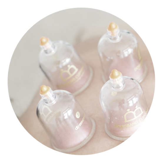 Photo d'une séance de ventouses