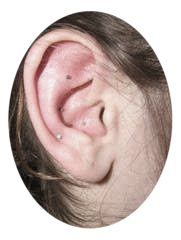 Photo des aiguilles utilisées pour l'auriculothérapie